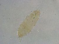 Mesobiotus liviae image