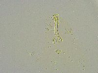 Mesobiotus liviae image