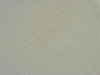 Mesobiotus liviae image