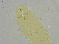 Mesobiotus liviae image