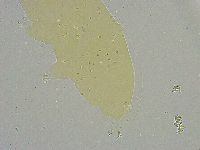 Mesobiotus liviae image