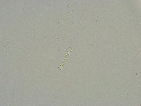 Mesobiotus liviae image