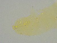 Mesobiotus liviae image