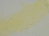 Mesobiotus liviae image