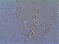 Mesobiotus liviae image