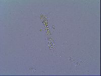 Mesobiotus liviae image
