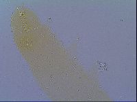 Mesobiotus liviae image