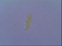 Mesobiotus liviae image