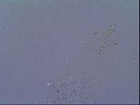 Mesobiotus liviae image
