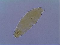 Mesobiotus liviae image