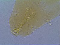 Mesobiotus liviae image