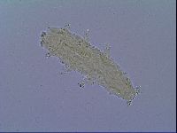 Mesobiotus liviae image