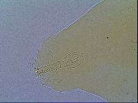 Mesobiotus liviae image