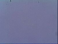 Mesobiotus coronatus image