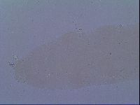 Mesobiotus snaresensis image