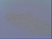 Mesobiotus snaresensis image