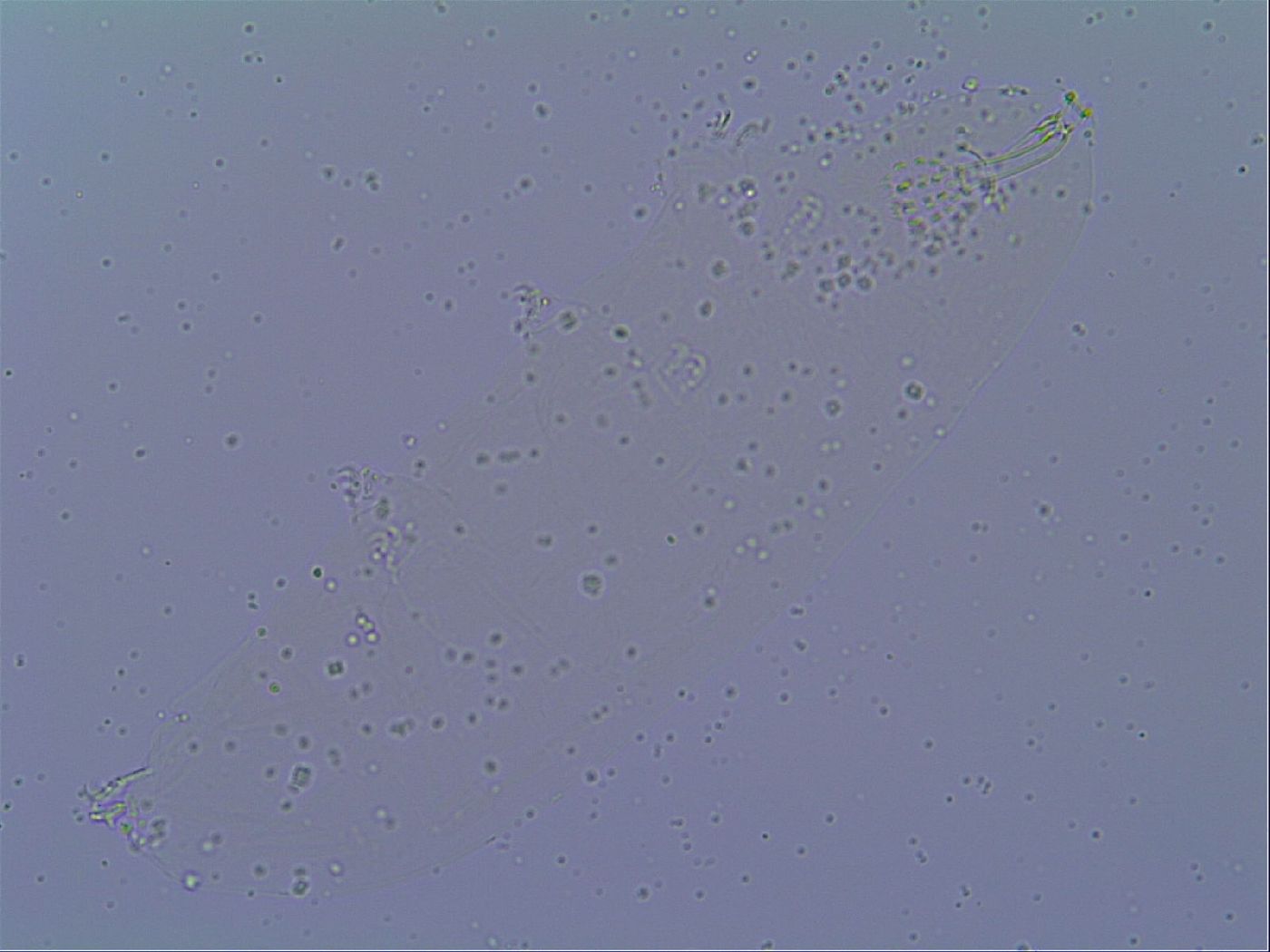 Mesobiotus snaresensis image