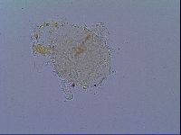 Mesobiotus snaresensis image