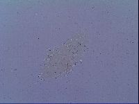 Mesobiotus snaresensis image