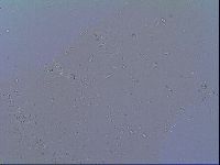 Mesobiotus snaresensis image
