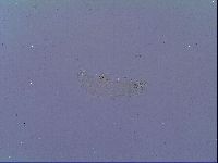 Mesobiotus snaresensis image