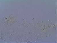 Mesobiotus snaresensis image