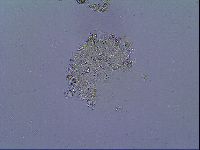 Mesobiotus coronatus image