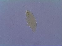 Mesobiotus coronatus image