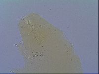 Mesobiotus coronatus image