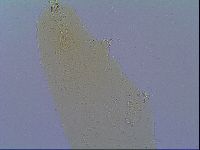 Mesobiotus coronatus image