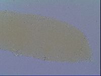 Mesobiotus coronatus image