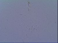Mesobiotus snaresensis image