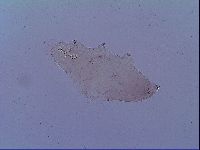 Mesobiotus snaresensis image