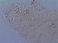 Mesobiotus snaresensis image