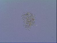 Mesobiotus snaresensis image