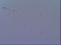 Mesobiotus snaresensis image
