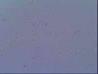 Mesobiotus snaresensis image