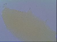 Mesobiotus snaresensis image