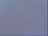 Mesobiotus snaresensis image