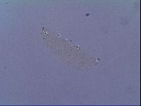 Mesobiotus snaresensis image