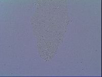 Mesobiotus snaresensis image