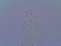 Mesobiotus snaresensis image