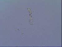 Mesobiotus snaresensis image