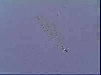 Mesobiotus snaresensis image
