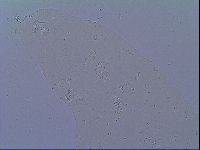Mesobiotus snaresensis image