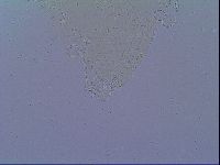 Mesobiotus snaresensis image
