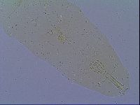 Mesobiotus snaresensis image