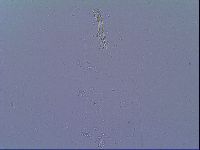 Mesobiotus snaresensis image