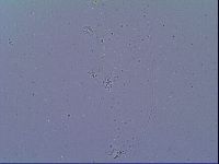 Mesobiotus snaresensis image
