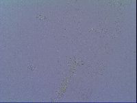 Mesobiotus snaresensis image